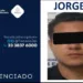 Practica estudiante una liposucción en un restaurante.Foto:Fiscalía del estado