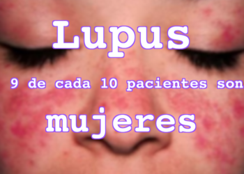 10 de mayo: Día Mundial del Lupus