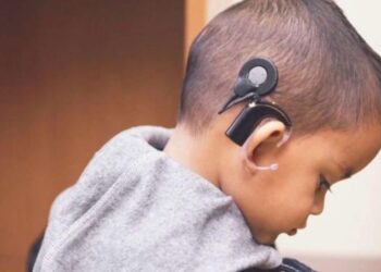 El IMSS otorgará implantes cocleares a niños y adolescentes