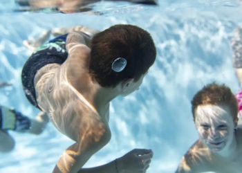 Otitis de verano, enfermedad común en época de calor que puede provocar sordera