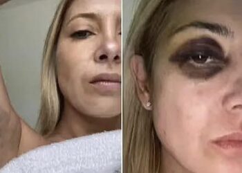El escándalo por violencia de género hunde a Alberto Fernández y arrastra a grupos feministas