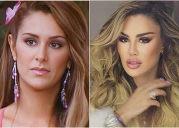 Ninel Conde y sus cambios en el rostro