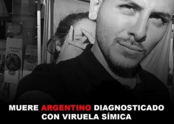 Primer muerto de viruela del mono en México era argentino