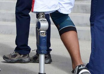 Aumenta número de personas con amputación de algún miembro y sin atención rápida y adecuada en México