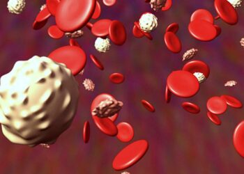 La incidencia en México de Leucemia Mieloide Aguda es mayor que en el resto del mundo.