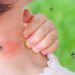 El aumento de las poblaciónes de mosquitos, una amenaza contra la salud.