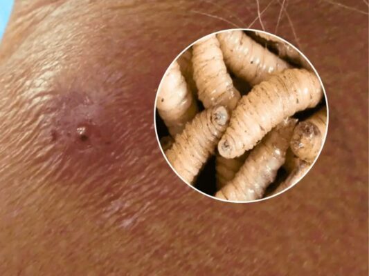 El gusano barrenador ya cobró su primera víctima en México una mujer muere en Campeche.