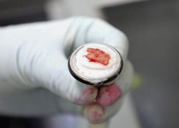 Cáncer tipo sarcoma. Riesgos y tratamientos. AMEXI