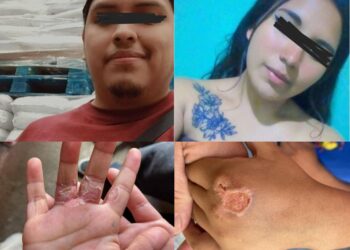 Padrastro, con la complicidad de la madre, torturaba a dos niños en Los Reyes La Paz. AMEXI