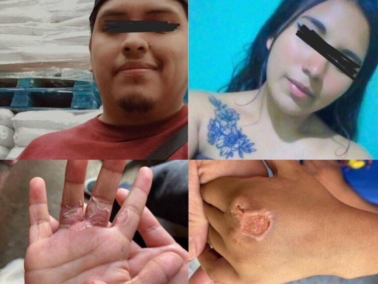 Padrastro, con la complicidad de la madre, torturaba a dos niños en Los Reyes La Paz. AMEXI