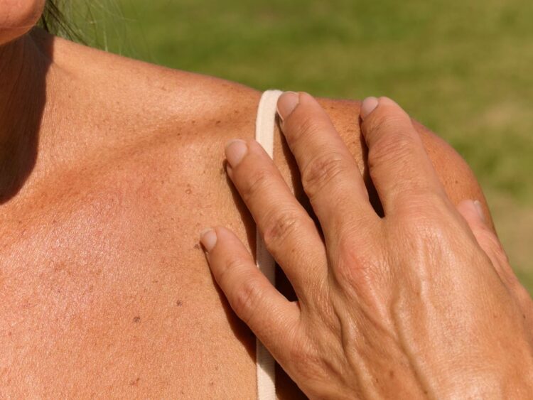 ¿Cuándo ocurre el mayor daño a la piel por radiación solar?