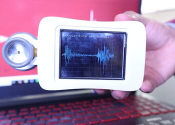 Estetoscopio digital desarrollado en el IPN que detecta daño cardiaco con IA. AMEXI Foto Cortesía IPN