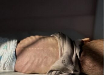 Condena Palestina indiferencia mundial ante hambruna en Gaza