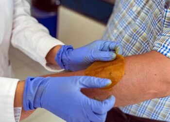 El tema de las quemaduras en el cuerpo y la atención médica a personas con lesiones graves , se puso de relieve debido a la explosión pipa.