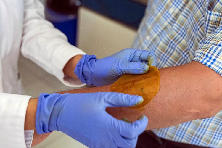 El tema de las quemaduras en el cuerpo y la atención médica a personas con lesiones graves , se puso de relieve debido a la explosión pipa.