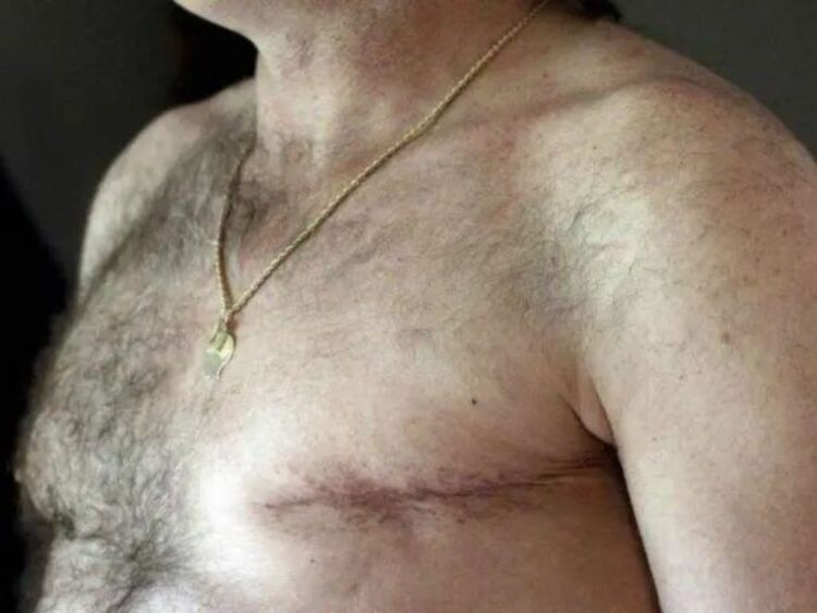 Cáncer de mama en hombres. Foto Especial