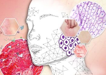 Psoriasis en México