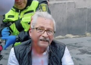 Jorge Federico de la Vega Membrillo, exalcalde de Texcoco, herido durante la marcha de la Generación Z en la CDMX. AMEXI Foto Especial