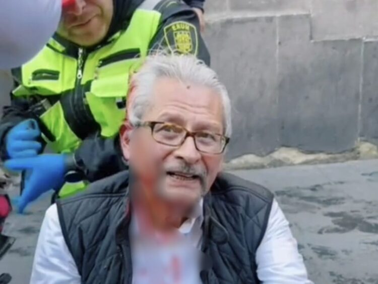 Jorge Federico de la Vega Membrillo, exalcalde de Texcoco, herido durante la marcha de la Generación Z en la CDMX. AMEXI Foto Especial