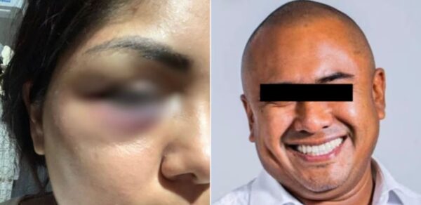 Sancionan al diputado Dante Montaño