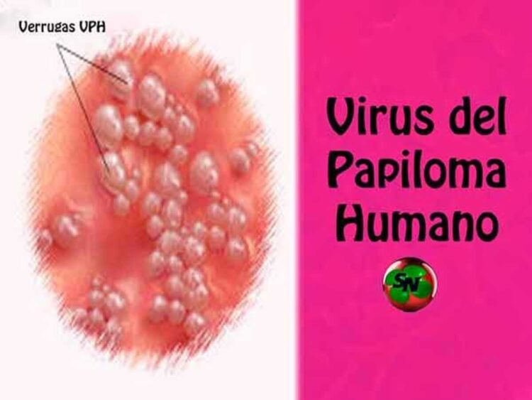 Esquema de vacunación contra el Virus del Papiloma Humano en infancias, ¿es efectivo?