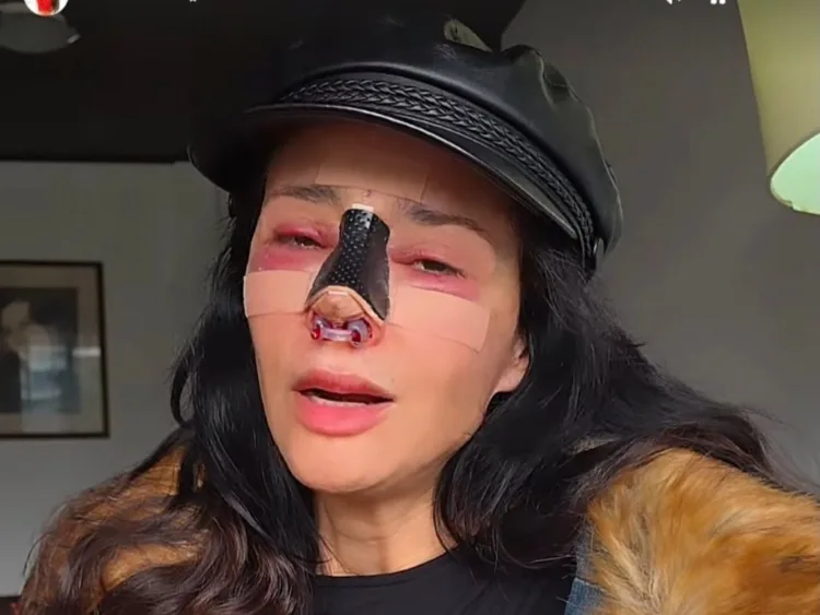 La modelo argentina Dorismar enfrenta graves secuelas por una cirugía estética. | AMEXI/FOTO: IG @dorismartv