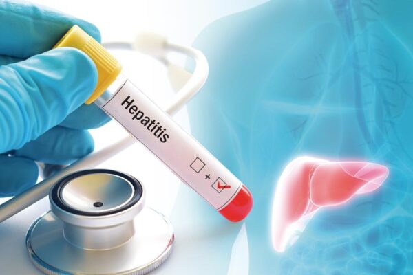 Solo el 13% de las personas con hepatitis B y el 36% con hepatitis C han sido diagnosticadas