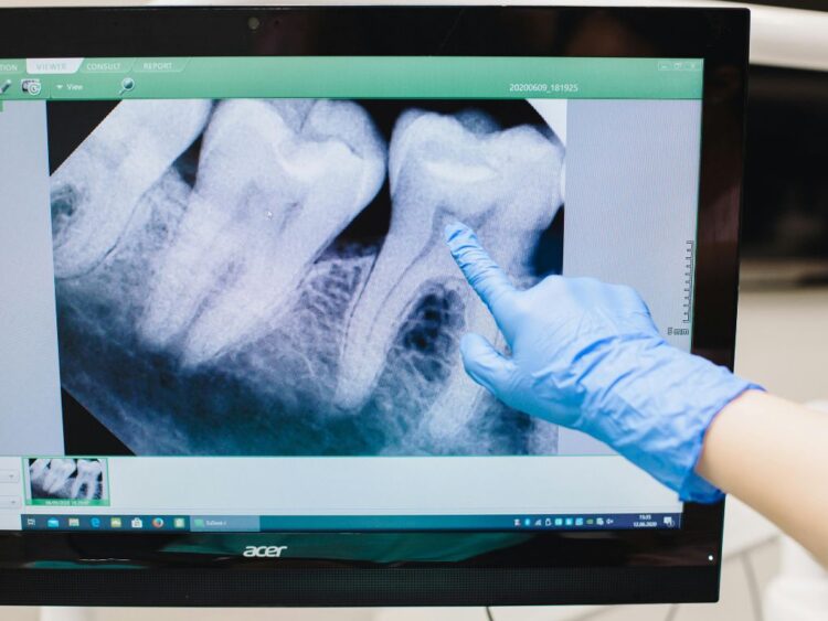 enfermedades bucales