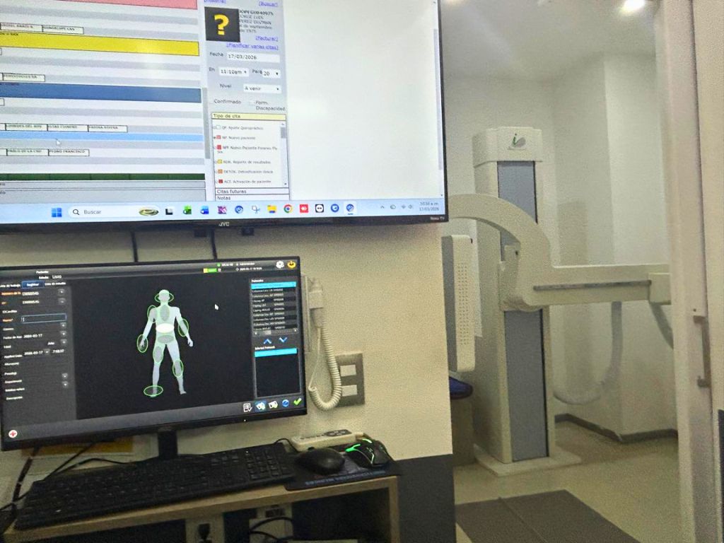 Crucial poner atención en los síntomas del dolor lumbar.