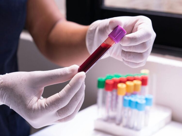 Descartan laboratorios de salud en Oaxaca casos de plomo en sangre de niñas indígenas