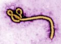Virus del Ébola