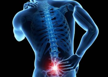 El dolor de espalda crónico y del cuello puede ser un síntoma de la espondilitis anquilosante. AMEXI/FOTO/ Redes Sociales