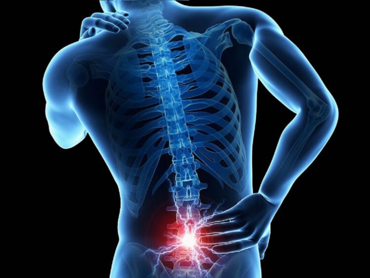 El dolor de espalda crónico y del cuello puede ser un síntoma de la espondilitis anquilosante. AMEXI/FOTO/ Redes Sociales