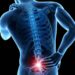El dolor de espalda crónico y del cuello puede ser un síntoma de la espondilitis anquilosante. AMEXI/FOTO/ Redes Sociales