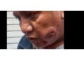 Profesor de la CNTE resulta herido  de bala en el rostro durante enfrentamiento en el Zócalo