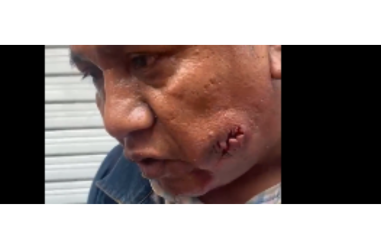 Profesor de la CNTE resulta herido de bala en el rostro durante enfrentamiento en el Zócalo