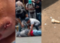 CNTE