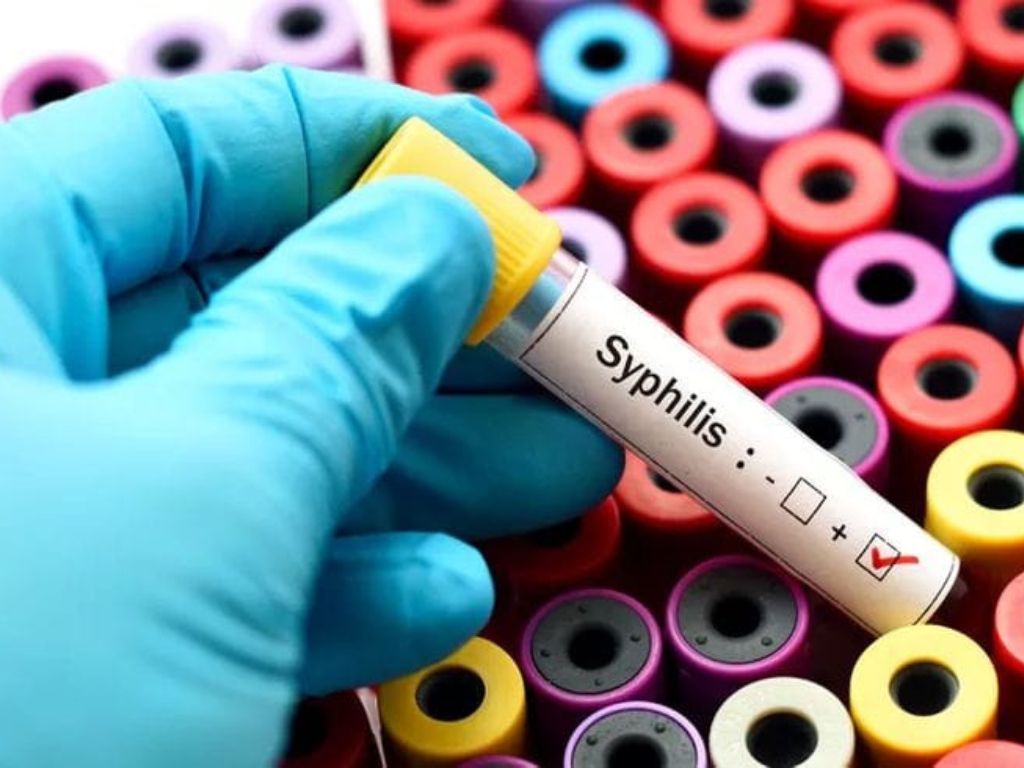¿Cada vez más mexicanos con sífilis ¿También los bebés?