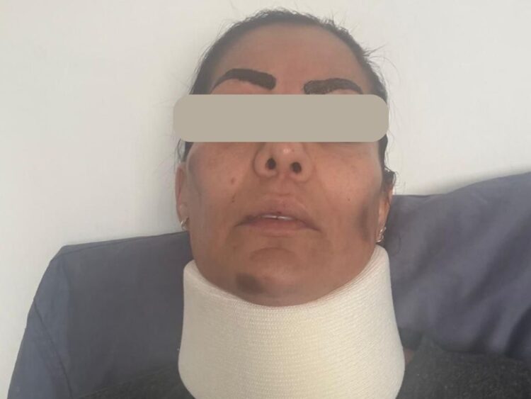 Víctima de tentativa de feminicidio en Morelos. AMEXI Foto Especial