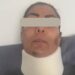 Víctima de tentativa de feminicidio en Morelos. AMEXI Foto Especial