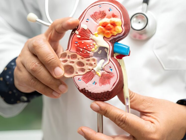 Enfermedad renal crónica. AMEXI Foto