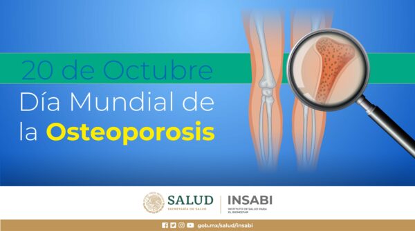 Osteoporosis: el padecimiento silencioso que aumenta el riesgo de fracturas. AMEXI/Foto: RRSS