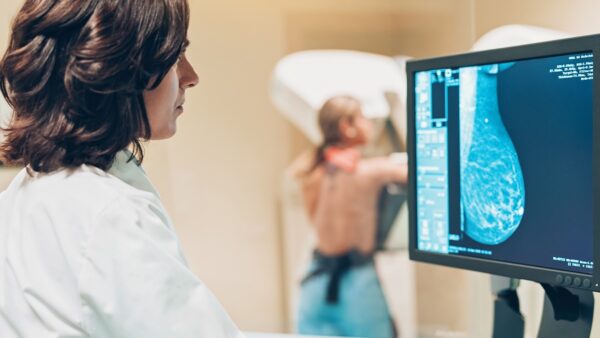 Con IA, IPN busca reducir tiempos de revisión en mastografías. AMEXI/Foto: CDC (Centros para el Control y la Prevención de Enfermedades)